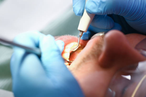 Best Emergency Root Canal Treatment in Van Horn, TX