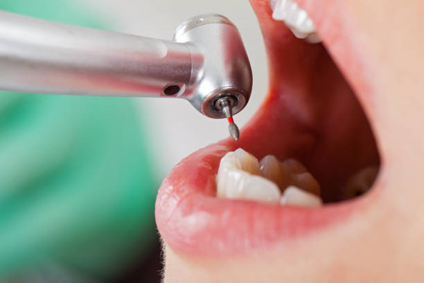 Best Emergency Root Canal Treatment in Van Horn, TX